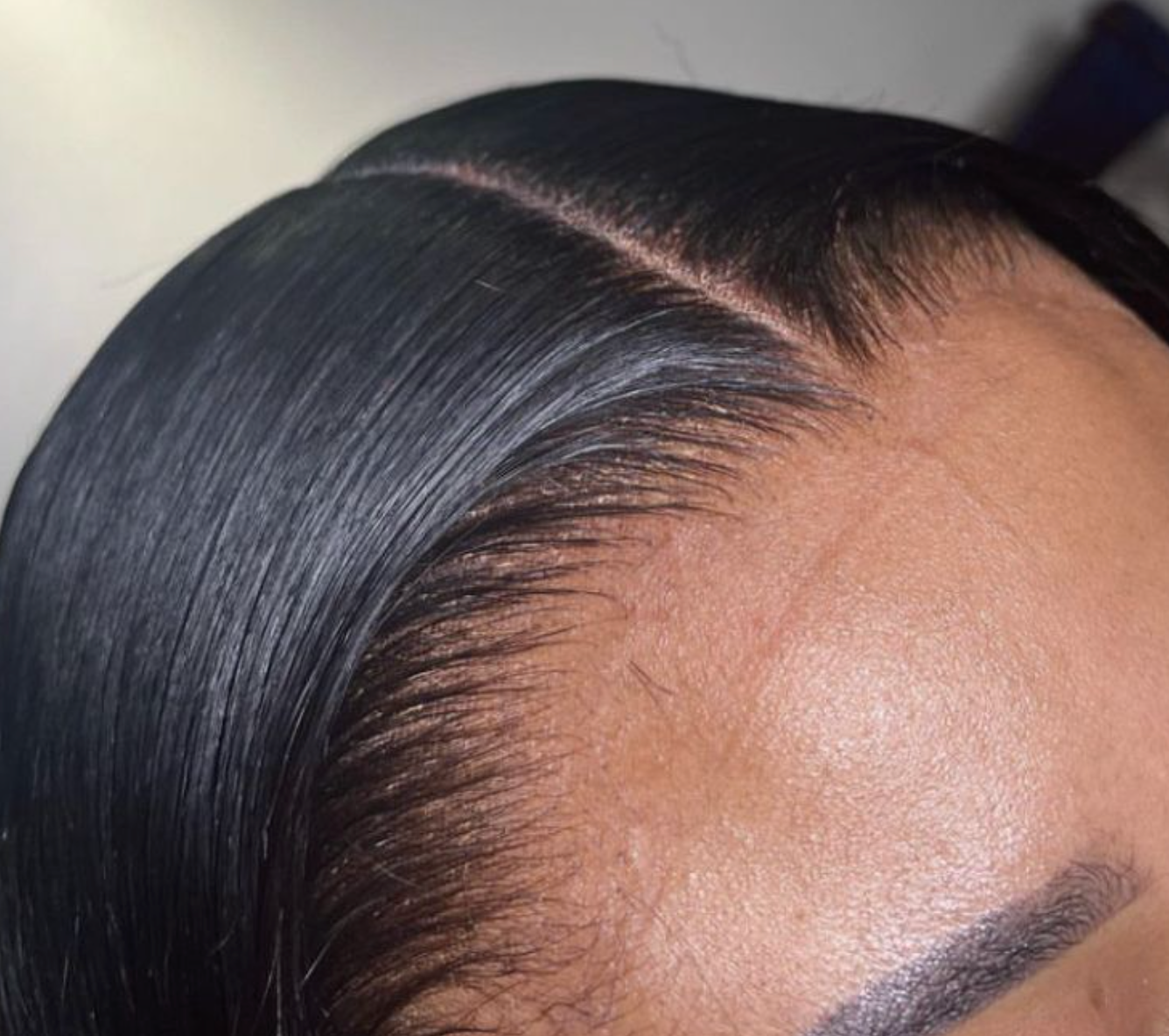 Hd Lace Frontals